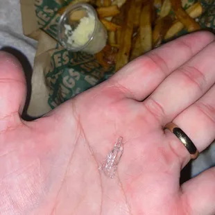 I bit into a piece of plastic while eating my fries...