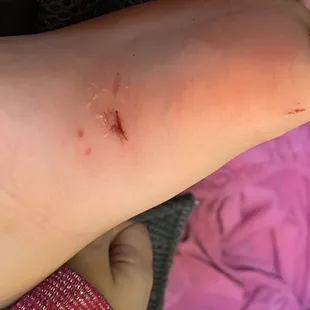 Cut foot on my kid from glass from the park !