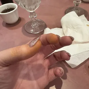 My fingers are now dyed yellow.