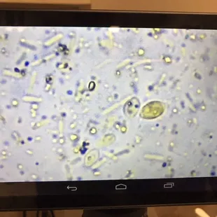 Giardia Cysts!
