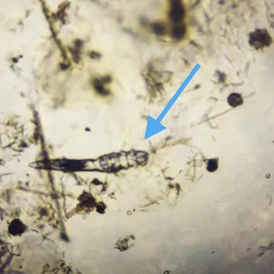 It's Creepy Critter Wednesday! This particular critter is a Demodectic mite.