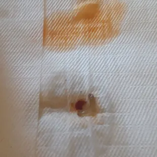 I found parasites in my soup and all she could say it was a beansprout. She did not apologize instead she decides to sueeze it.