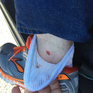 Injury