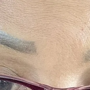 This is her work !! She uses bad Botox when you buy on Groupon or if she don't like you.  She is very unprofessional.