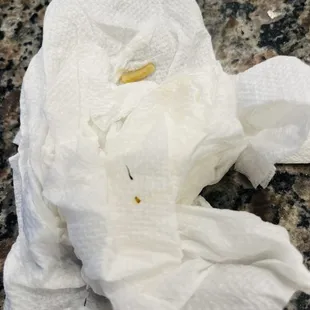 Leg of a bug in Hibachi Noodle